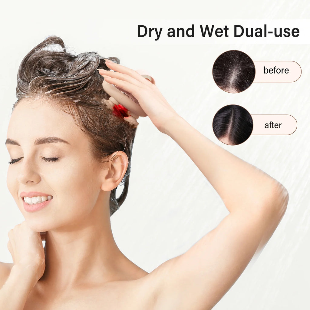 Electric Waterproof Scalp Massager IPX7 with 8 Removable Claws - Rose